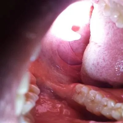 口气大主要是什么原因