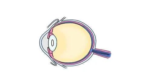 两眼红红的是红眼病吗