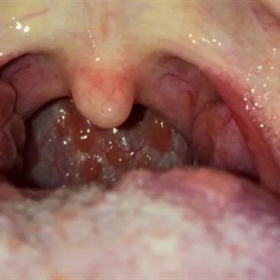 口气大主要是什么原因