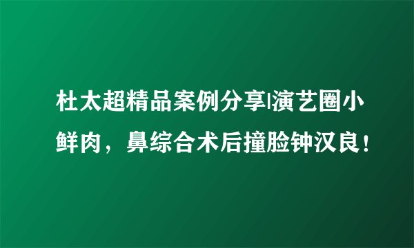 杜太超精品案例分享|演艺圈小鲜肉，鼻综合术后撞脸钟汉良！