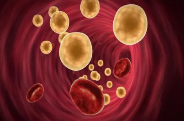 血浆脂蛋白是如何分类的？各有何功能？