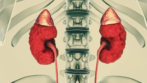 肾盂肾炎的症状有哪些