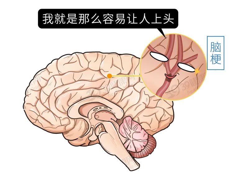 身体有这3个症状,可能是脑梗在“敲门”,第一时间打120去医院