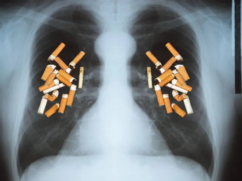 肺癌晚期还能活多久