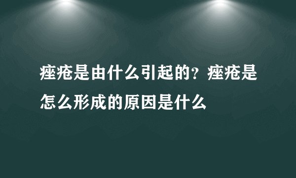 痤疮是由什么引起的？痤疮是怎么形成的原因是什么