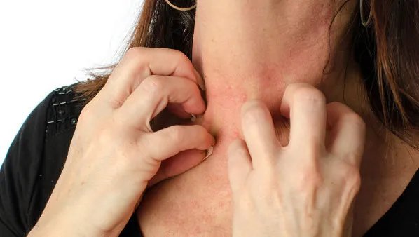 带状疱疹的治疗