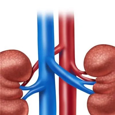 肾囊肿该怎么治疗