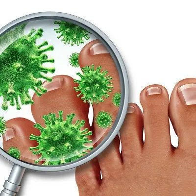 脚气是什么原因造成的?