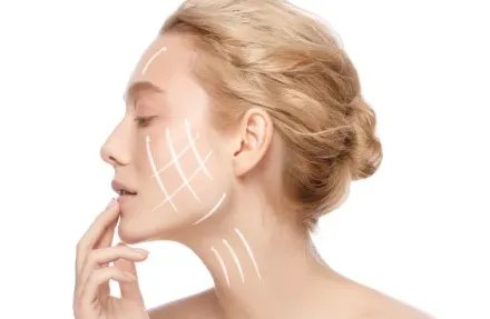 ipl光子嫩肤和m22区别