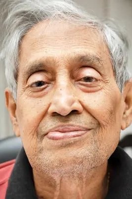 手脚浮肿是什么原因引起的