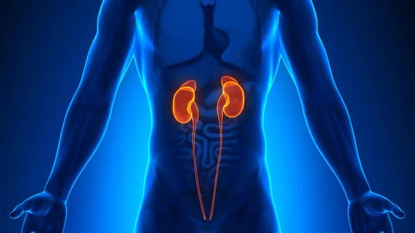 肾结石怎么治疗