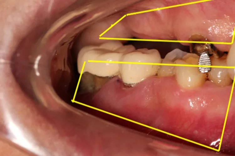 口腔舌侧颊侧腭侧区分图片