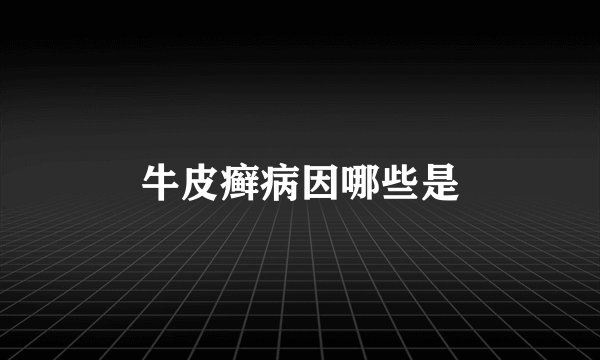 牛皮癣病因哪些是