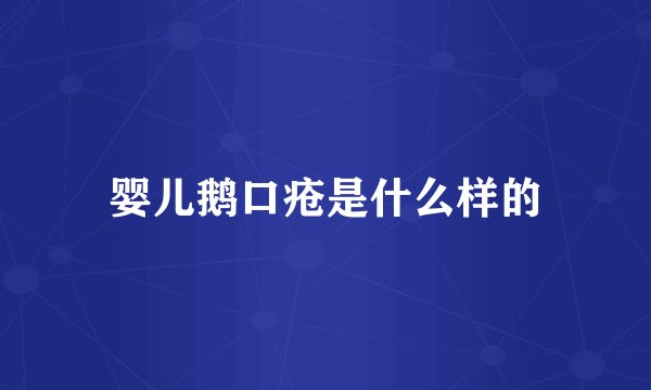 婴儿鹅口疮是什么样的