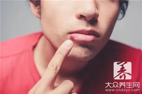 嘴角溃疡怎样好的最快？