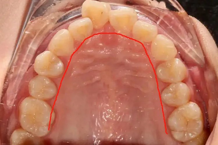 口腔舌侧颊侧腭侧区分图片