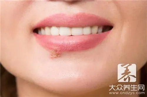 嘴角溃疡怎样好的最快？