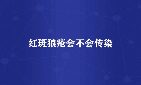 红斑狼疮会不会传染