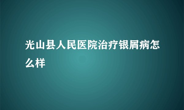 光山县人民医院治疗银屑病怎么样