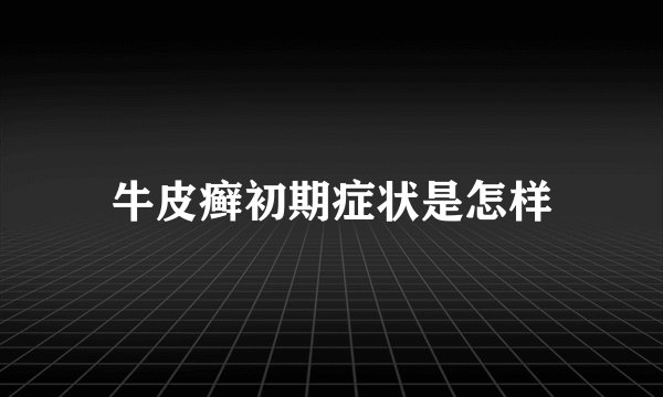 牛皮癣初期症状是怎样
