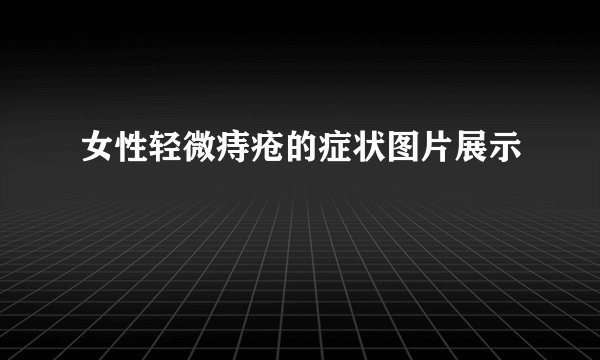女性轻微痔疮的症状图片展示