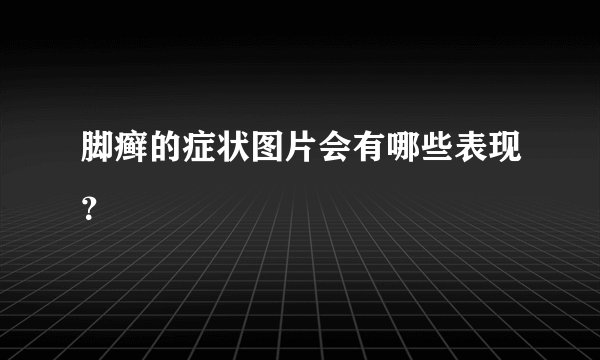 脚癣的症状图片会有哪些表现？