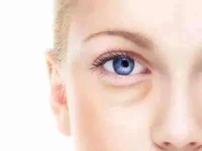 眼部抽脂的效果