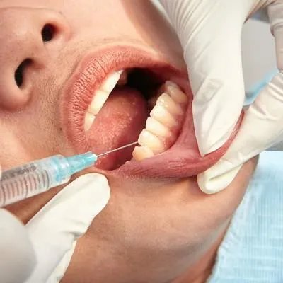 长智齿吃什么药