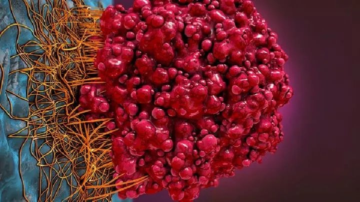 癌症是怎么检查出来的？