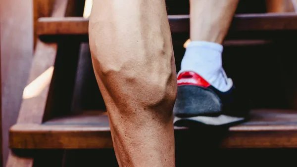 下肢溃疡的病因是什么