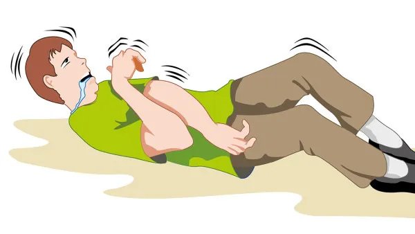 癫痫发作怎么急救