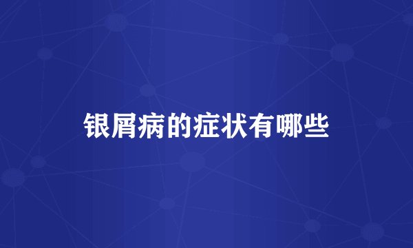 银屑病的症状有哪些